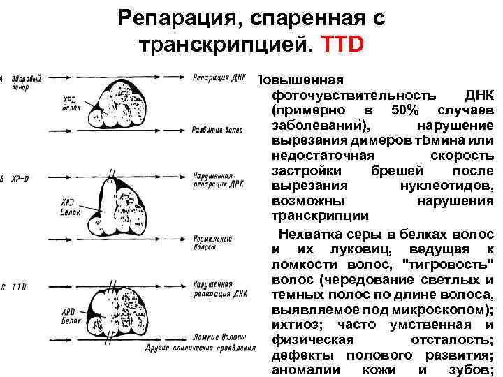 Репарация, спаренная с транскрипцией. TTD Повышенная фоточувствительность ДНК (примерно в 50% случаев заболеваний), нарушение