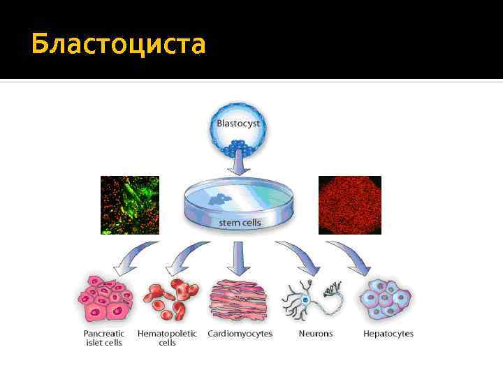 Бластоциста 