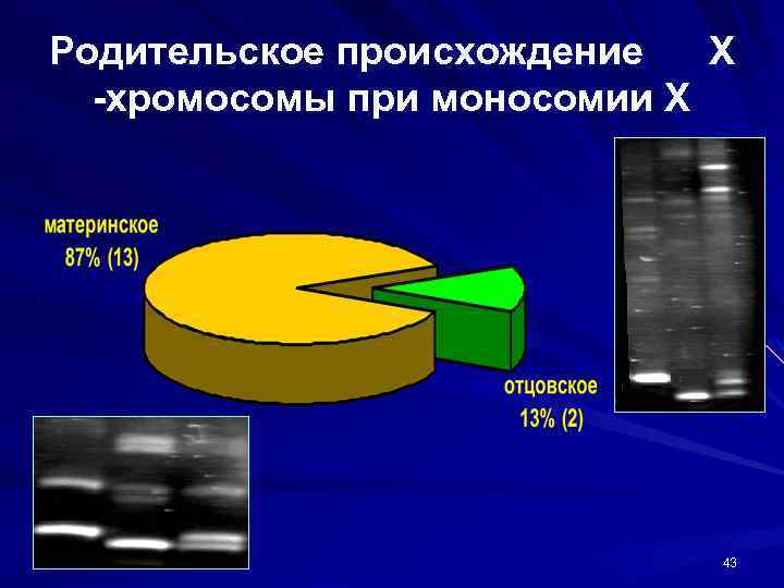 Родительское происхождение Х -хромосомы при моносомии Х 43 