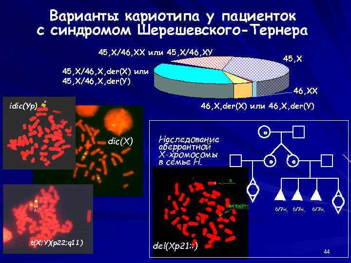 Варианты кариотипа у пациенток с синдромом Шерешевского-Тернера 45, X/46, XX или 45, X/46, XY