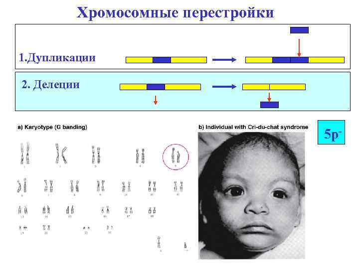 Делеции и дупликации