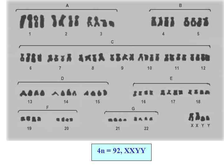 4 n = 92, XXYY 