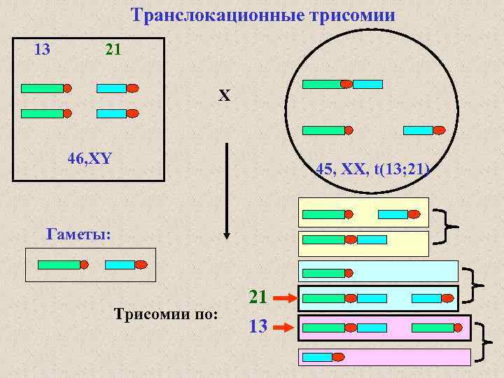 Транслокационные трисомии 13 21 X 46, ХY 45, XX, t(13; 21) Гаметы: Трисомии по: