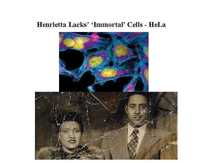 Henrietta Lacks’ ‘Immortal’ Cells - He. La 