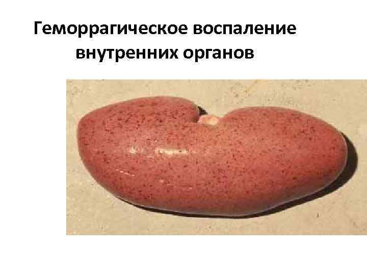 Геморрагическое воспаление внутренних органов 