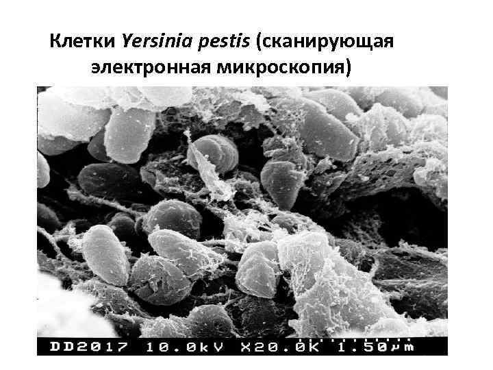 Клетки Yersinia pestis (сканирующая электронная микроскопия) 