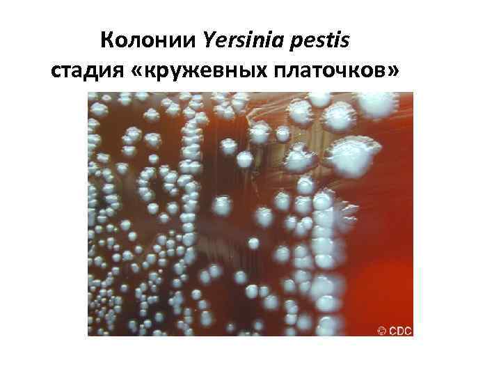 Колонии Yersinia pestis стадия «кружевных платочков» 