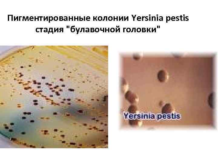 Пигментированные колонии Yersinia pestis стадия "булавочной головки" 