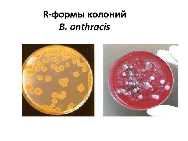 R-формы колоний B. anthracis 