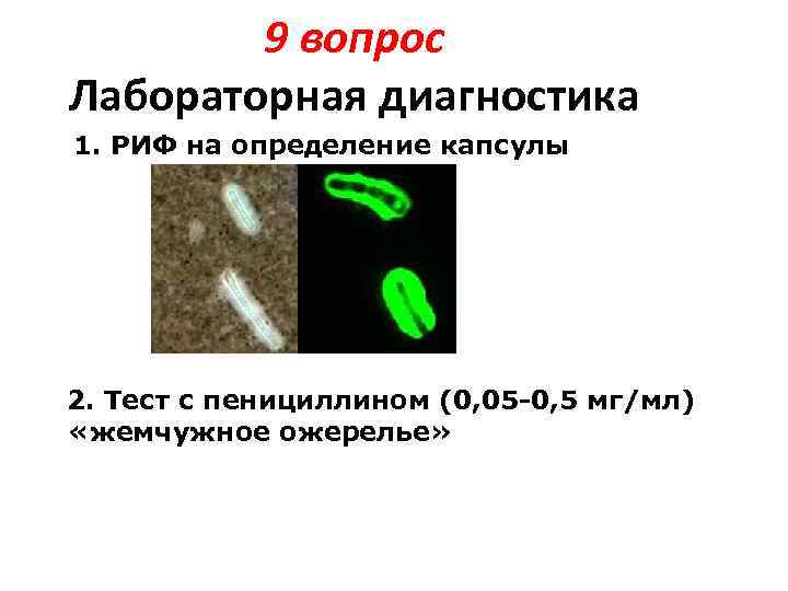 9 вопрос Лабораторная диагностика 1. РИФ на определение капсулы 2. Тест с пенициллином (0,