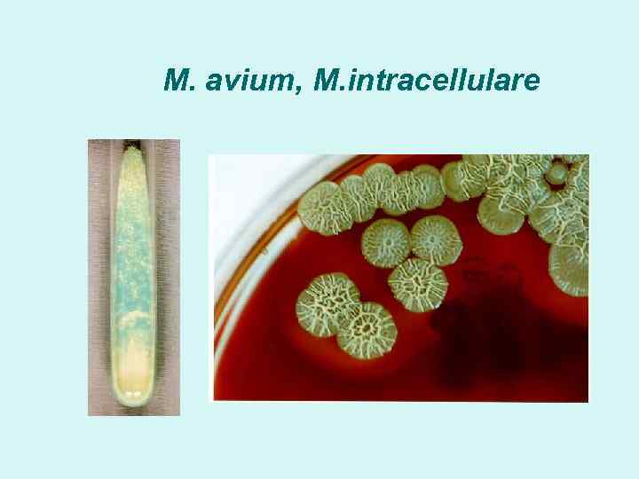 M. avium, M. intracellulare 