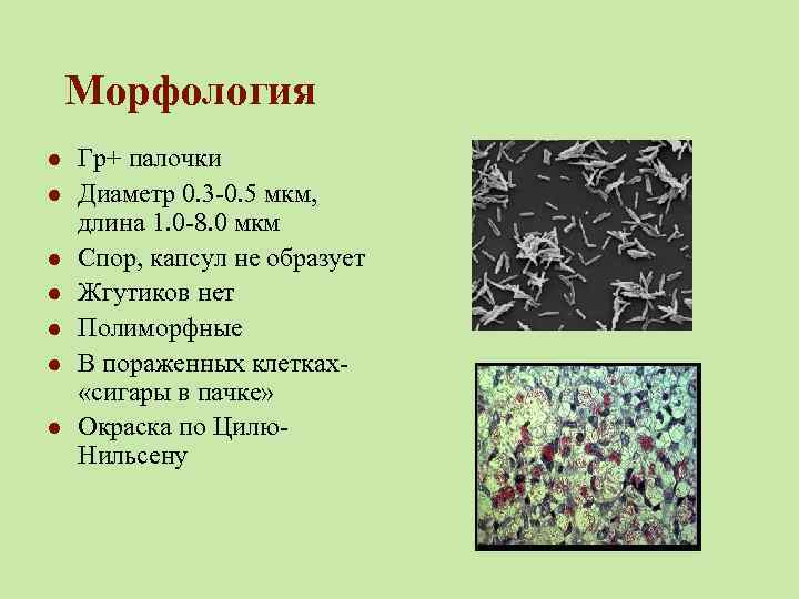 Морфология l l l l Гр+ палочки Диаметр 0. 3 -0. 5 мкм, длина