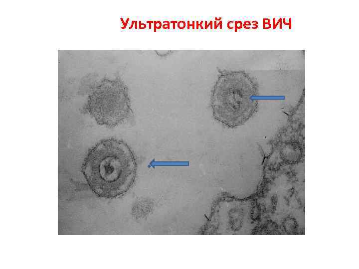 Ультратонкий срез ВИЧ 