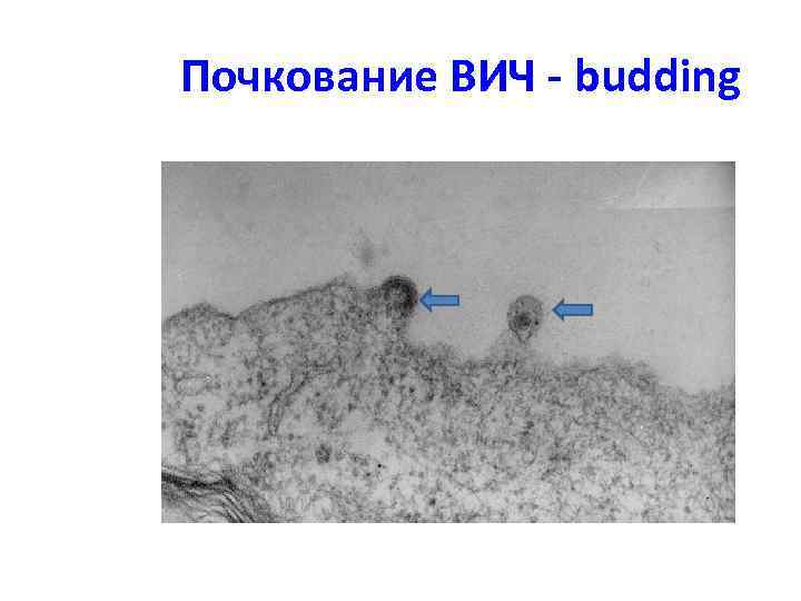 Почкование ВИЧ - budding 