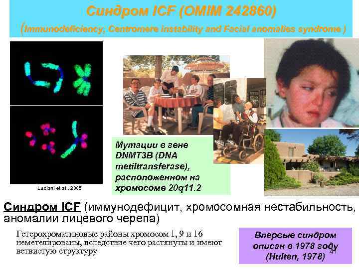Синдром ICF (OMIM 242860) (Immunodeficiency, Centromere instability and Facial anomalies syndrome ) Luciani et