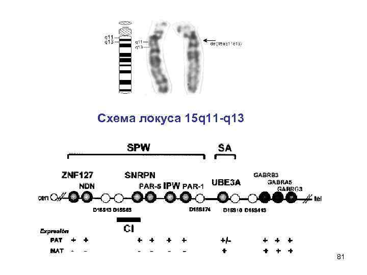 Схема локуса 15 q 11 -q 13 81 