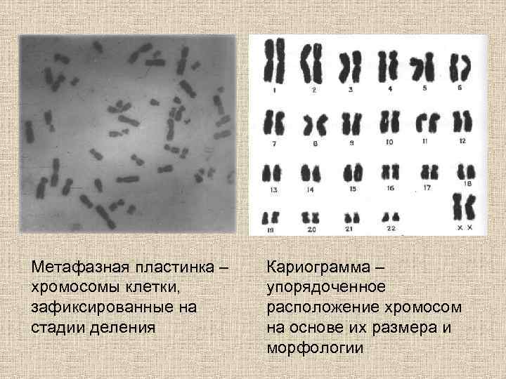 Метафазная пластинка – хромосомы клетки, зафиксированные на стадии деления Кариограмма – упорядоченное расположение хромосом