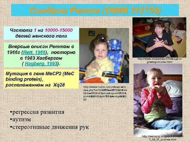 Синдром Ретта (OMIM 312750) Частота 1 на 10000 -15000 детей женского пола Впервые описан