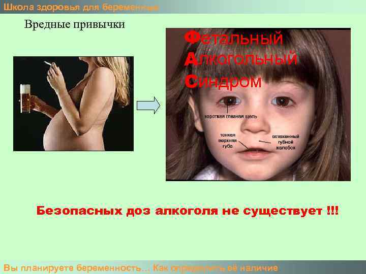 Школа здоровья для беременных Вредные привычки Фетальный Алкогольный Синдром Безопасных доз алкоголя не существует