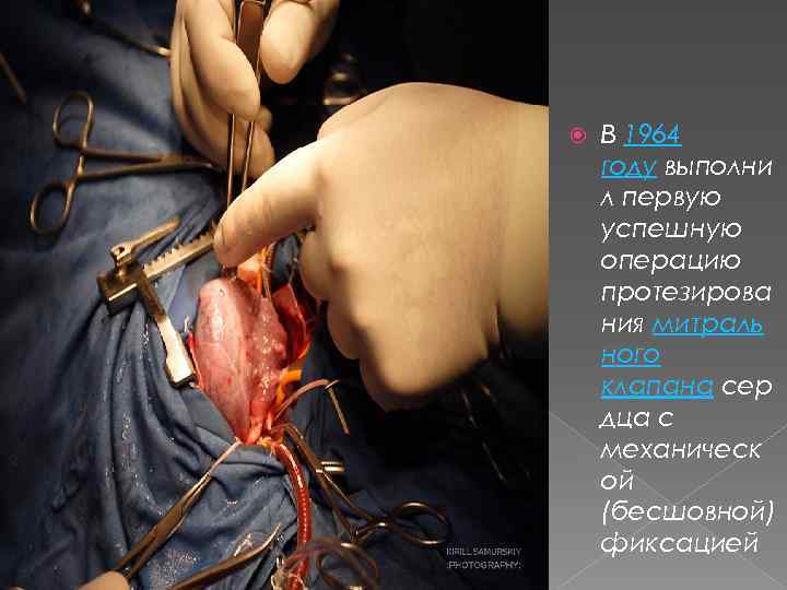  В 1964 году выполни л первую успешную операцию протезирова ния митраль ного клапана