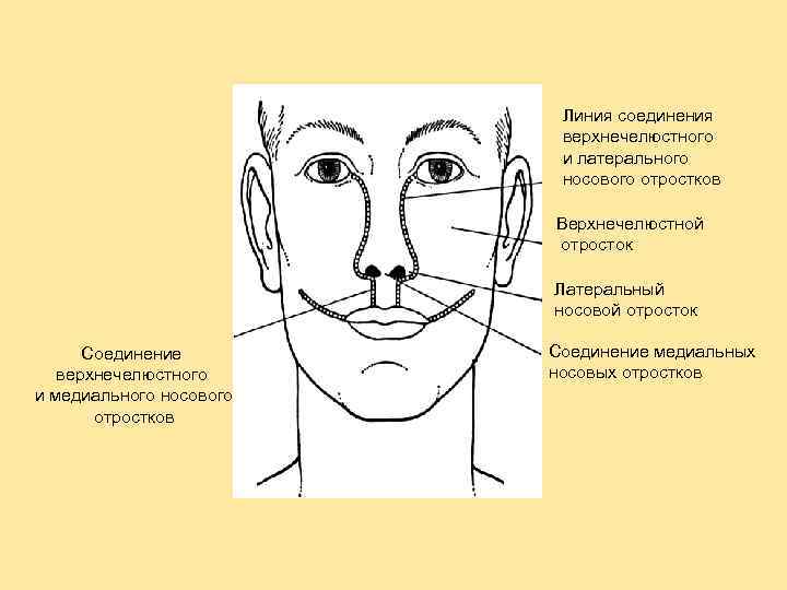 Линия соединения верхнечелюстного и латерального носового отростков Верхнечелюстной отросток Латеральный носовой отросток Соединение верхнечелюстного