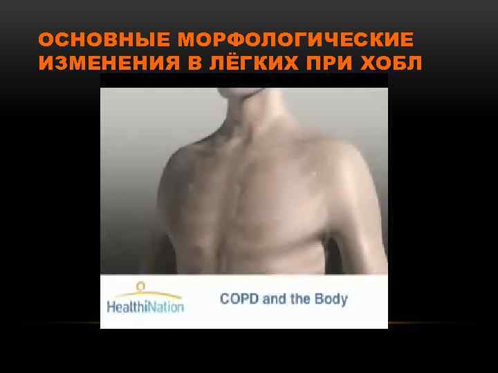 ОСНОВНЫЕ МОРФОЛОГИЧЕСКИЕ ИЗМЕНЕНИЯ В ЛЁГКИХ ПРИ ХОБЛ 