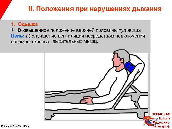 II. Положения при нарушениях дыхания 1. Одышка Ø Возвышенное положение верхней половины туловища Цель: