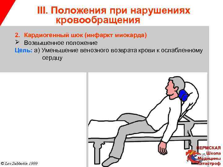 III. Положения при нарушениях кровообращения 2. Кардиогенный шок (инфаркт миокарда) Ø Возвышенное положение Цель: