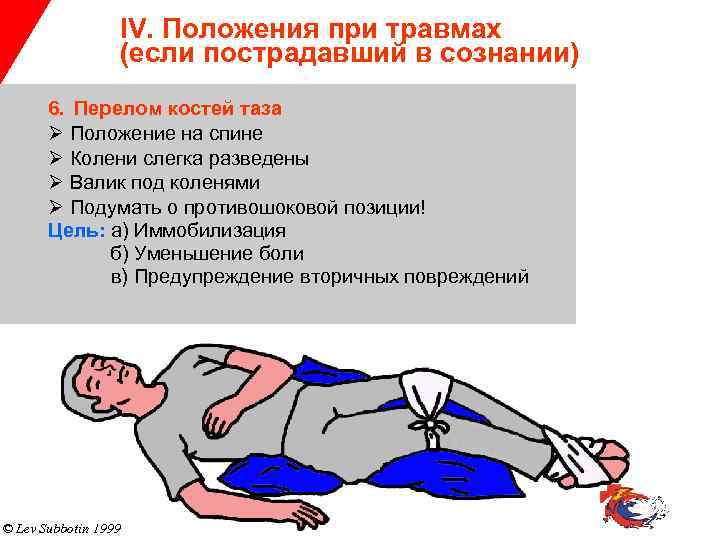 IV. Положения при травмах (если пострадавший в сознании) 6. Перелом костей таза Ø Положение