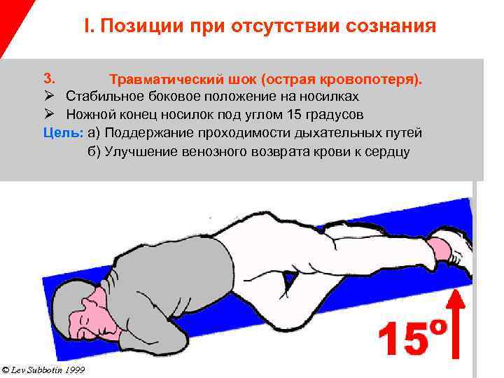 I. Позиции при отсутствии сознания 3. Травматический шок (острая кровопотеря). Ø Стабильное боковое положение