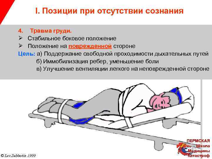 I. Позиции при отсутствии сознания 4. Травма груди. Ø Стабильное боковое положение Ø Положение
