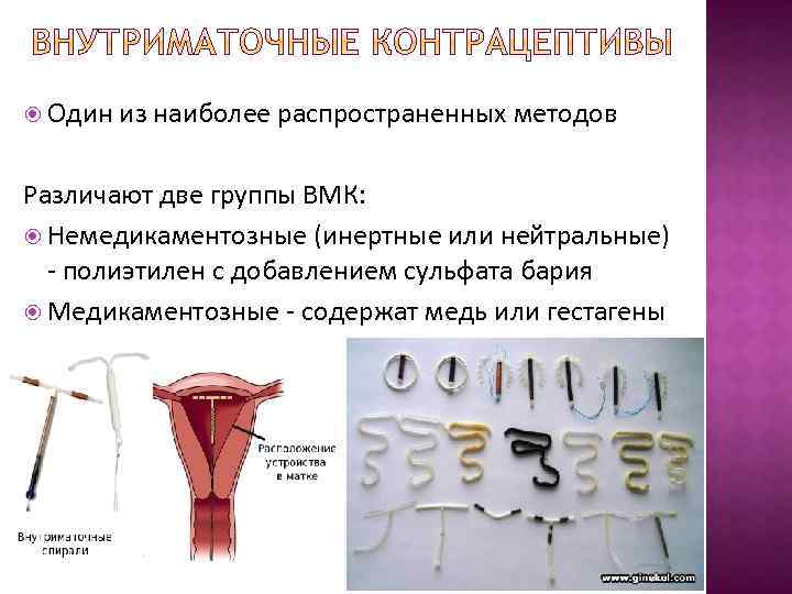 Кайлина лнг сист внутримат тереапев спираль внутриматочная