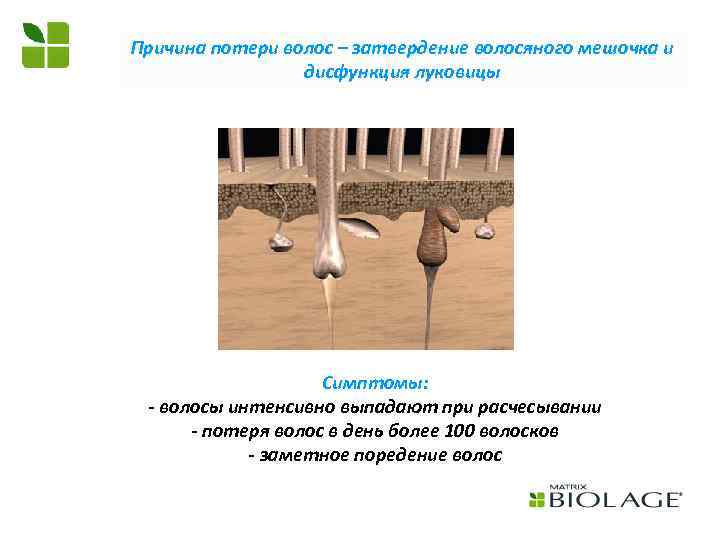 Причина потери волос – затвердение волосяного мешочка и дисфункция луковицы Симптомы: - волосы интенсивно