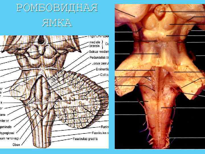 Ромбовидная ямка анатомия рисунок