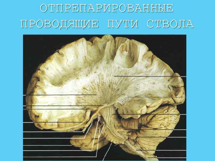 Проводящие волокна мозга. Corona Radiata анатомия. Лучистый венец головного мозга анатомия. Лучистый венец анатомия. Внутренняя капсула и Лучистый венец.