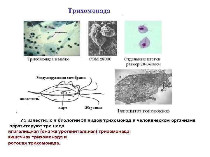 Трихомонада Из известных в биологии 50 видов трихомонад в человеческом организме паразитируют три вида: