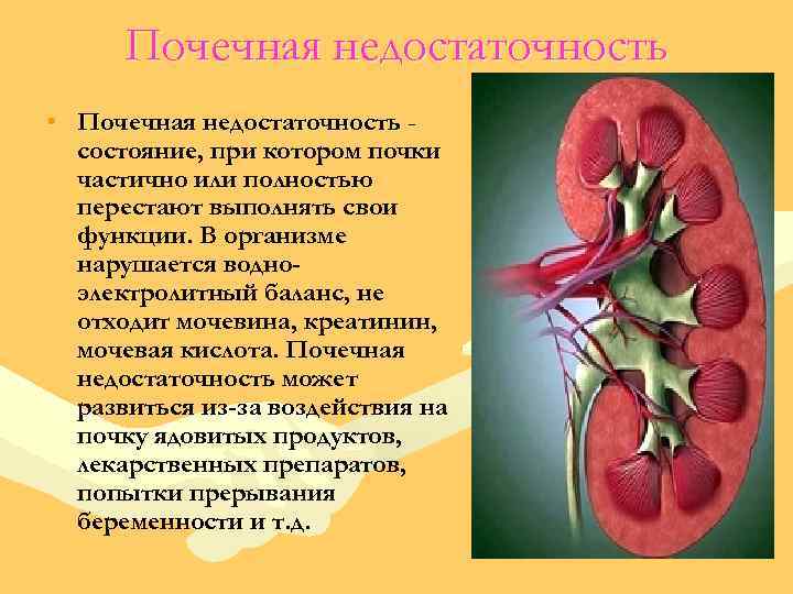 Почечная недостаточность • Почечная недостаточность состояние, при котором почки частично или полностью перестают выполнять