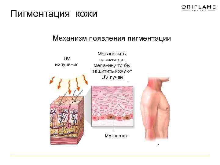 Пигментация кожи Механизм появления пигментации UV излучения Меланоциты производят меланин, что-бы защитить кожу от