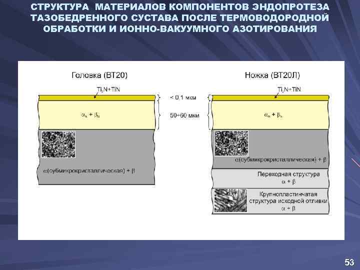 СТРУКТУРА МАТЕРИАЛОВ КОМПОНЕНТОВ ЭНДОПРОТЕЗА ТАЗОБЕДРЕННОГО СУСТАВА ПОСЛЕ ТЕРМОВОДОРОДНОЙ ОБРАБОТКИ И ИОННО-ВАКУУМНОГО АЗОТИРОВАНИЯ 53 