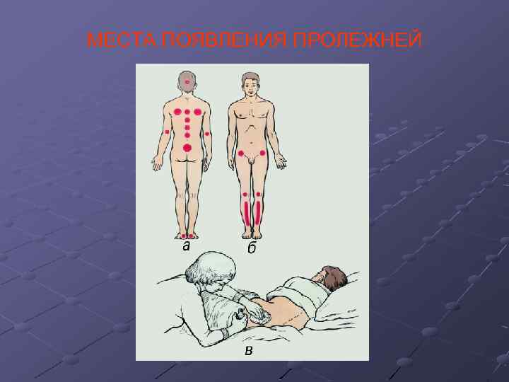 МЕСТА ПОЯВЛЕНИЯ ПРОЛЕЖНЕЙ 