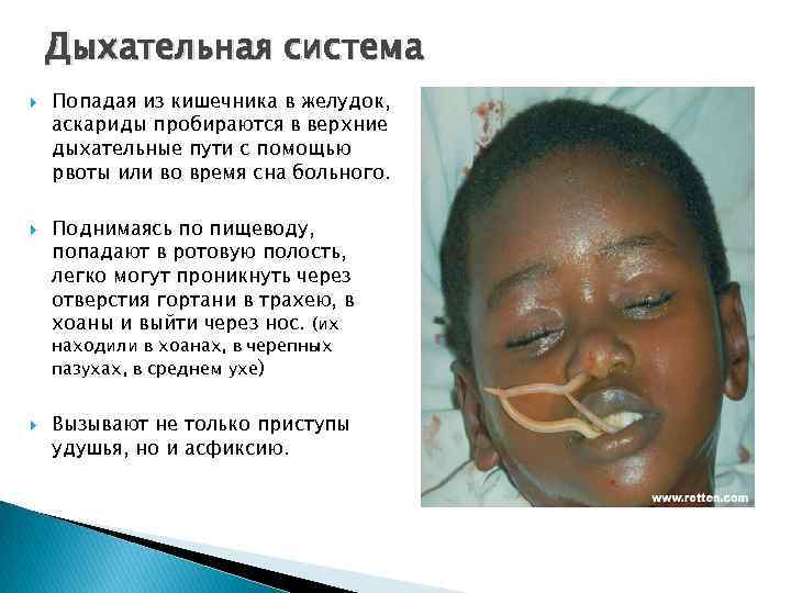 Дыхательная система Попадая из кишечника в желудок, аскариды пробираются в верхние дыхательные пути с