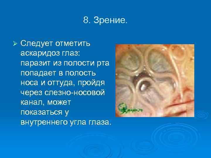 8. Зрение. Ø Следует отметить аскаридоз глаз: паразит из полости рта попадает в полость