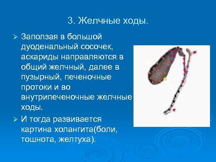 3. Желчные ходы. Заползая в большой дуоденальный сосочек, аскариды направляются в общий желчный, далее