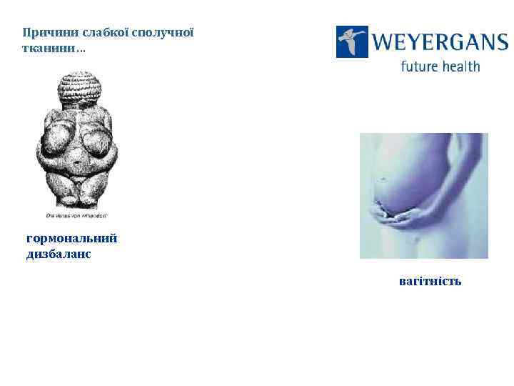 Причини слабкої сполучної тканини… гормональний дизбаланс вагітність 
