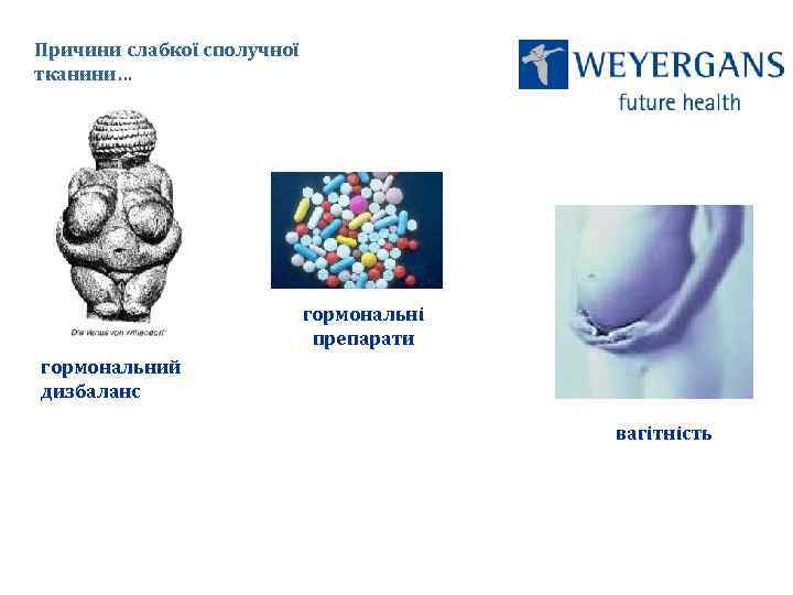 Причини слабкої сполучної тканини… гормональні препарати гормональний дизбаланс вагітність 