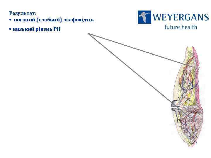 Результат: • поганий (слабкий) лімфовідтік • низький рівень РН 