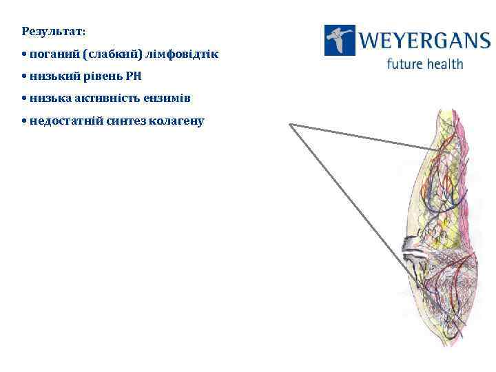 Результат: • поганий (слабкий) лімфовідтік • низький рівень РН • низька активність ензимів •