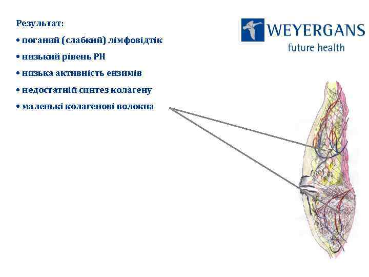 Результат: • поганий (слабкий) лімфовідтік • низький рівень РН • низька активність ензимів •