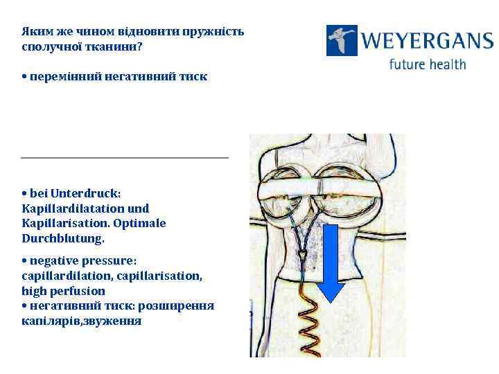 Яким же чином відновити пружність сполучної тканини? • перемінний негативний тиск • bei Unterdruck: