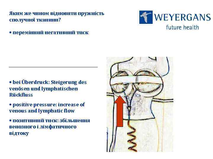 Яким же чином відновити пружність сполучної тканини? • перемінний негативний тиск • bei Überdruck: